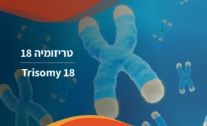 Trisomy 18