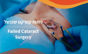 Failed Cataract Surgery